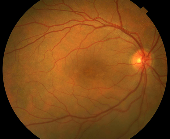 Clinical image example